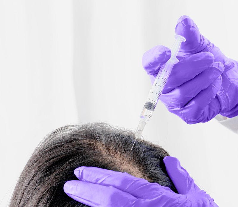 Injectable for Hair Loss Treatment